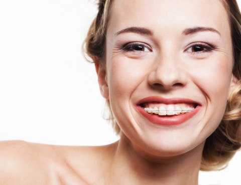 photodune-4465792-smile-with-dental-braces-s